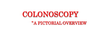 COLONOSCOPY
-A PICTORIAL OVERVIEW
 