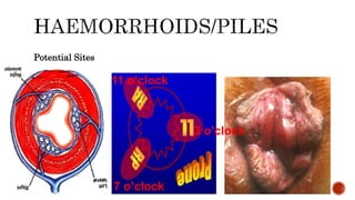 Potential Sites
3 o’clock
7 o’clock
11 o’clock
 