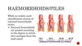 While no widely used
classification system of
external hemorrhoids
exists,
 Internal hemorrhoids
are graded according
to the degree to which
they prolapse from the
anal canal:
 