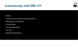 Colonoscopy with EMI-137
 
