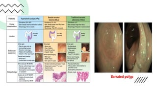 Defiant Polyp colonoscopy polyp detection characterization and maagment.pptx