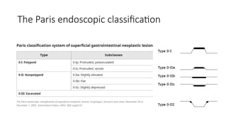 Colorectal polyps: recognition, characterisation and management | PPTX