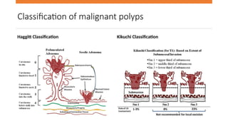 Colorectal polyps: recognition, characterisation and management | PPTX