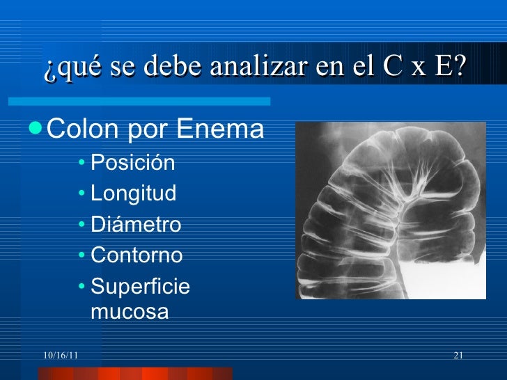 preparacion para colon por enema doble contraste preparacion para colon por enema doble contraste