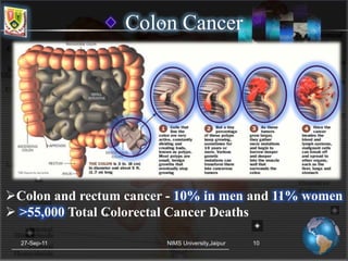 Colon Specific Drug Delivery System | PPTX