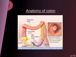 Anatomy of colon
(3/75)
 