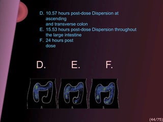 D. E. F.
D. 10.57 hours post-dose Dispersion at
ascending
and transverse colon
E. 15.53 hours post-dose Dispersion throughout
the large intestine
F. 24 hours post
dose
(44/75)
 