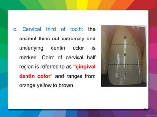 color.ppt in dentistry complete dental c | PPT