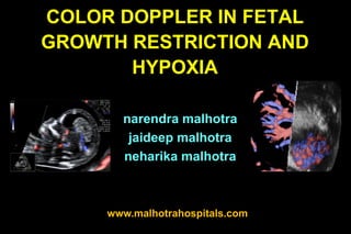 COLOR DOPPLER IN FETAL
GROWTH RESTRICTION AND
       HYPOXIA

       narendra malhotra
        jaideep malhotra
       neharika malhotra



     www.malhotrahospitals.com
 