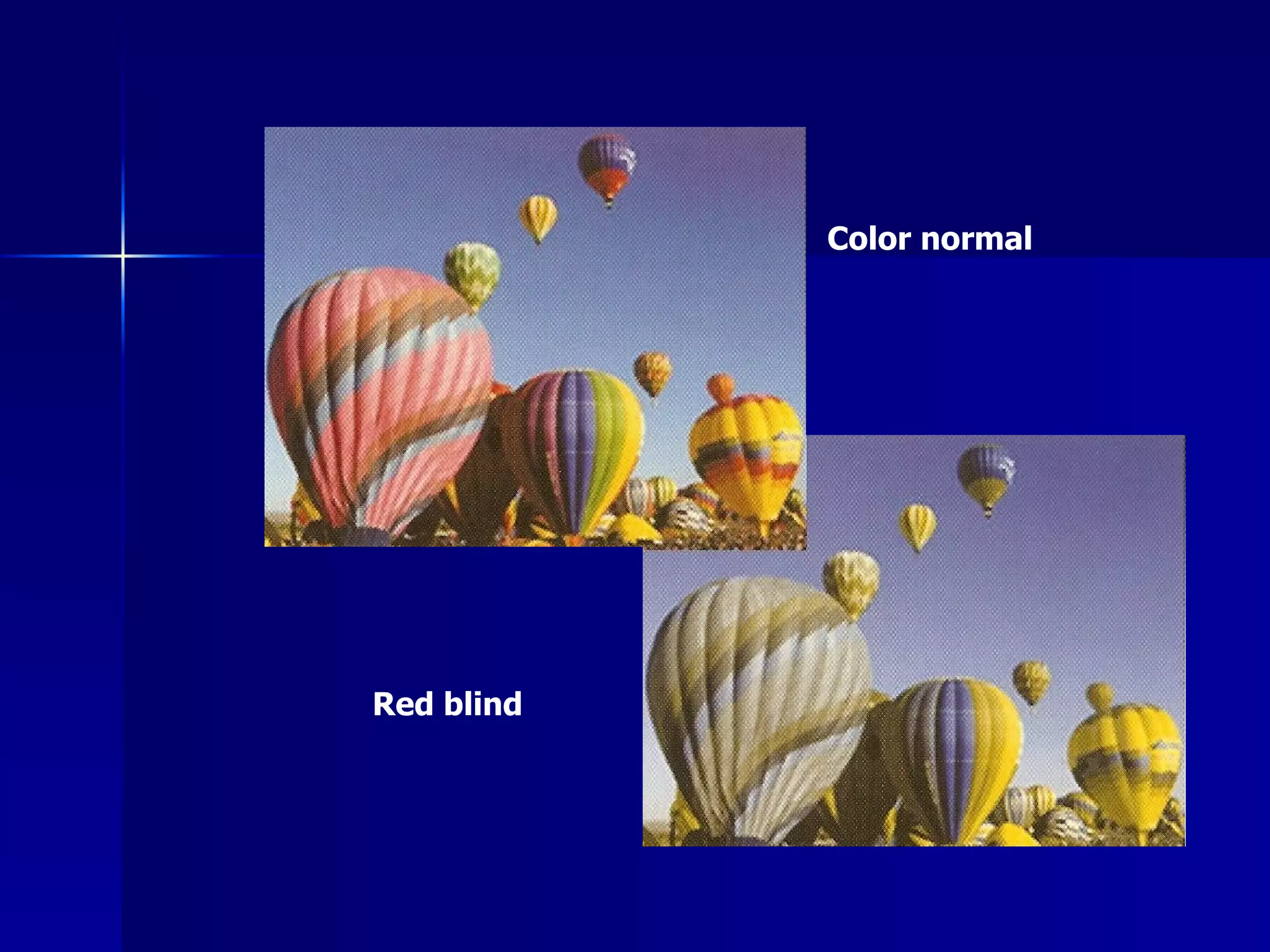 Color normal Red blind 