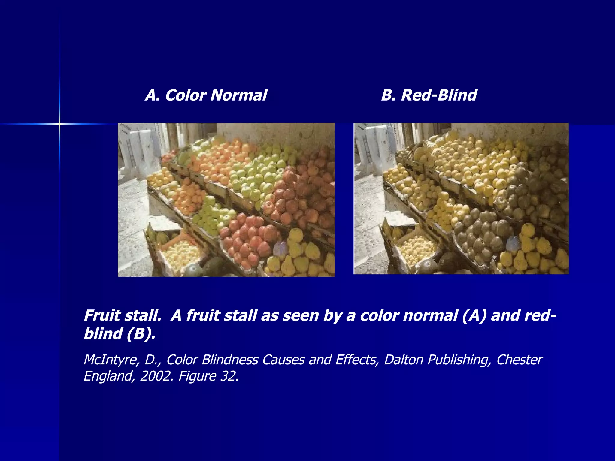 B. Red-Blind A. Color Normal Fruit stall.  A fruit stall as seen by a color normal (A) and red-blind (B). McIntyre, D., Color Blindness Causes and Effects, Dalton Publishing, Chester England, 2002. Figure 32. 