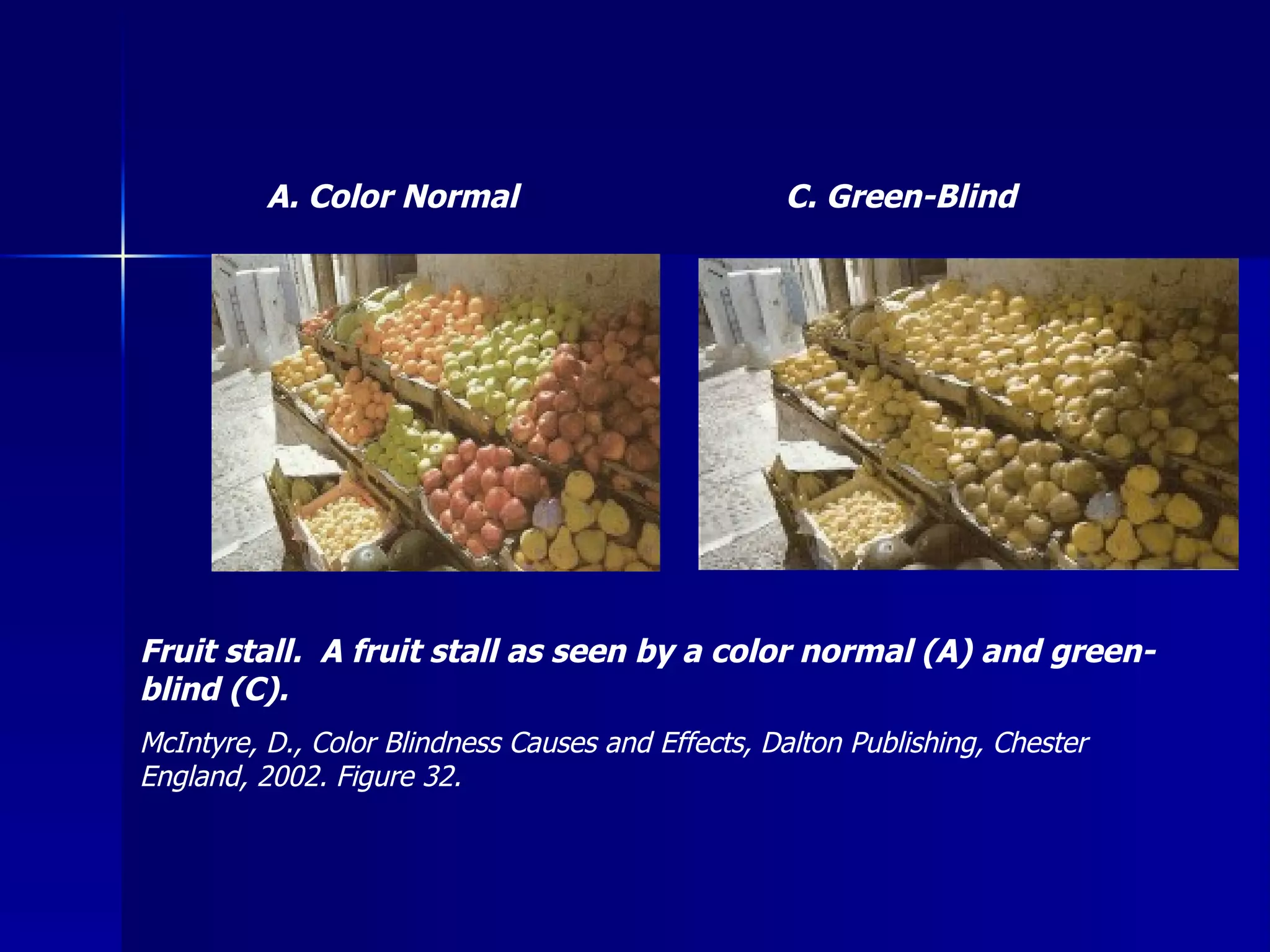 C. Green-Blind A. Color Normal Fruit stall.  A fruit stall as seen by a color normal (A) and green-blind (C). McIntyre, D., Color Blindness Causes and Effects, Dalton Publishing, Chester England, 2002. Figure 32. 