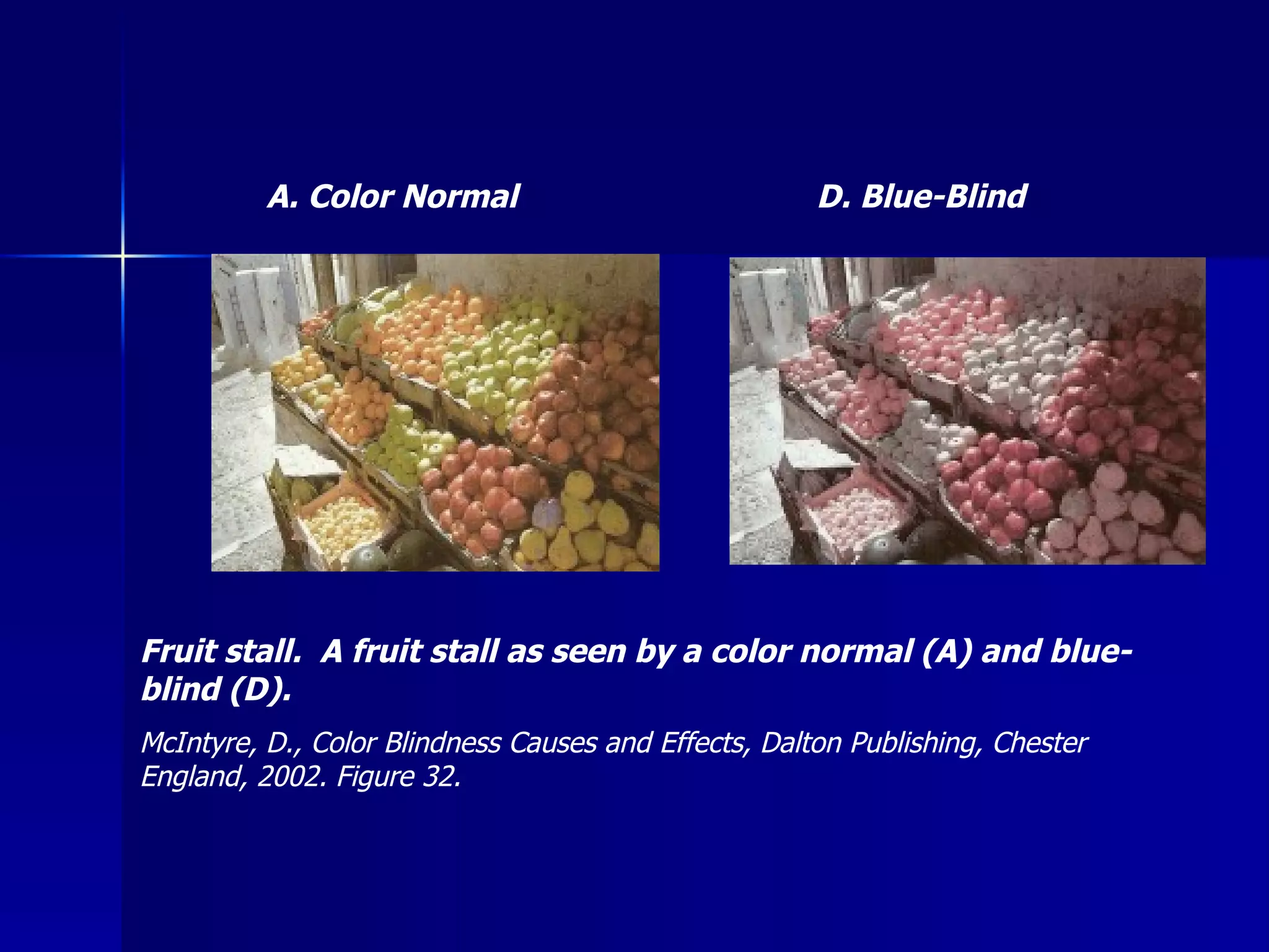 D. Blue-Blind A. Color Normal Fruit stall.  A fruit stall as seen by a color normal (A) and blue-blind (D). McIntyre, D., Color Blindness Causes and Effects, Dalton Publishing, Chester England, 2002. Figure 32. 