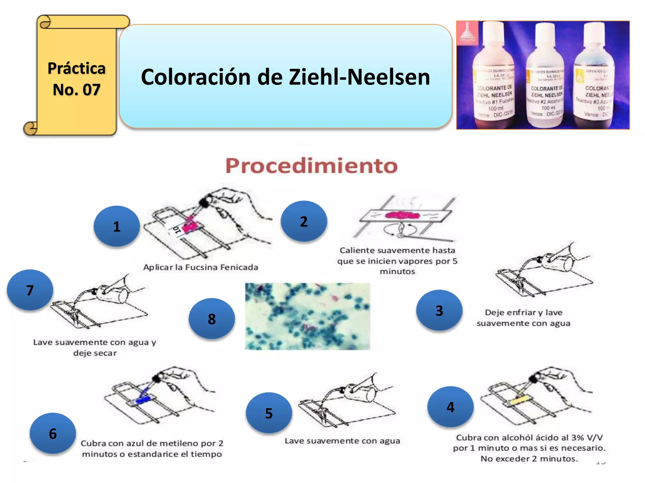 coloraci-n-de-ziehl-neelsen-ppt