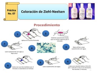 Coloración de Ziehl-Neelsen.ppt
