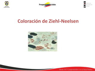 Coloración de Ziehl-Neelsen

 