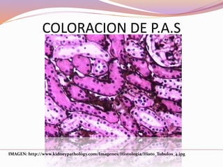 COLORACION DE P.A.S
IMAGEN: http://www.kidneypathology.com/Imagenes/Histologia/Histo_Tubulos_4.jpg
 