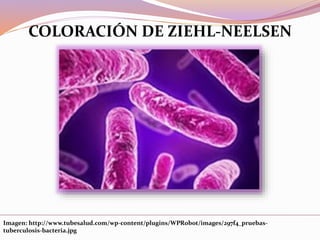Imagen: http://www.tubesalud.com/wp-content/plugins/WPRobot/images/297f4_pruebas-
tuberculosis-bacteria.jpg
COLORACIÓN DE ZIEHL-NEELSEN
 