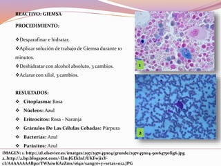 REACTIVO: GIEMSA
PROCEDIMIENTO:
Desparafinar e hidratar.
Aplicar solución de trabajo de Giemsa durante 10
minutos.
Deshidratar con alcohol absoluto, 3 cambios.
Aclarar con xilol, 3 cambios.
RESULTADOS:
 Citoplasma: Rosa
 Núcleos: Azul
 Eritrocitos: Rosa - Naranja
 Gránulos De Las Células Cebadas: Púrpura
 Bacterias: Azul
 Parásitos: Azul
1
IMAGEN: 1. http://zl.elsevier.es/imatges/297/297v45n04/grande/297v45n04-90164750fig6.jpg
2. http://2.bp.blogspot.com/-Eln1JGEklnI/UKFwjixY-
cI/AAAAAAAABp0/TWA0wKAzZms/s640/sangre+y+setas+012.JPG
2
 
