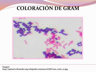 Imagen:
http://upload.wikimedia.org/wikipedia/commons/8/8f/Gram_stain_01.jpg
COLORACIÓN DE GRAM
 