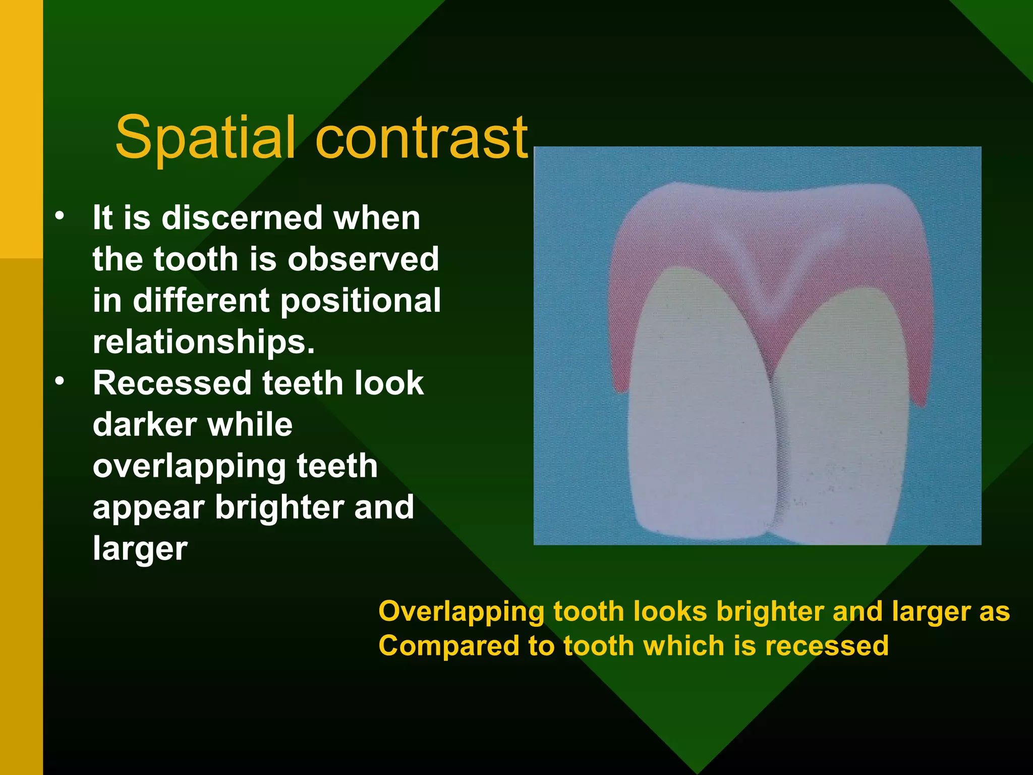 Spatial contrast
• It is discerned when
the tooth is observed
in different positional
relationships.
• Recessed teeth look
darker while
overlapping teeth
appear brighter and
larger
Overlapping tooth looks brighter and larger as
Compared to tooth which is recessed
 