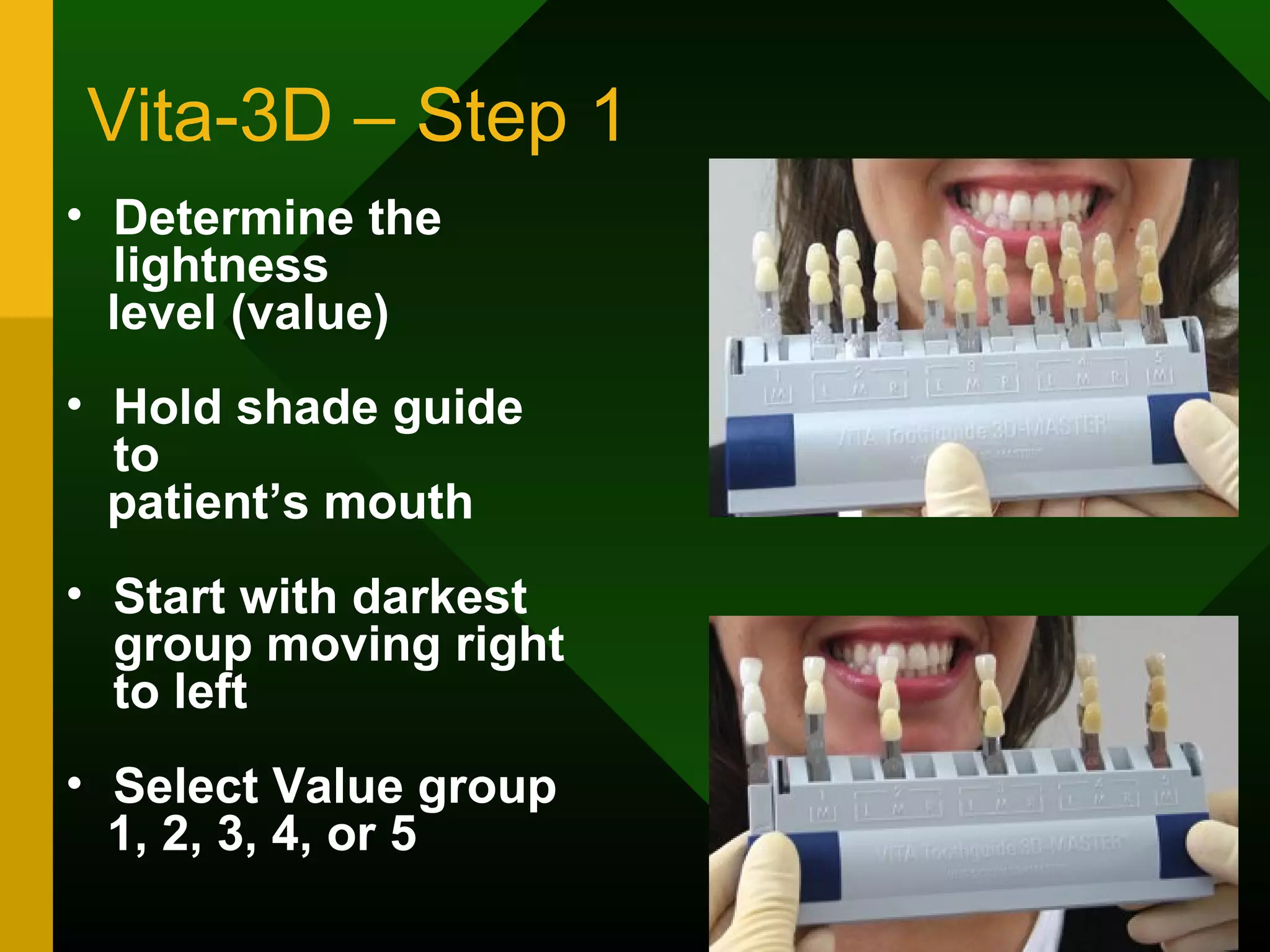 Vita-3D – Step 1
• Determine the
lightness
level (value)
• Hold shade guide
to
patient’s mouth
• Start with darkest
group moving right
to left
• Select Value group
1, 2, 3, 4, or 5
 