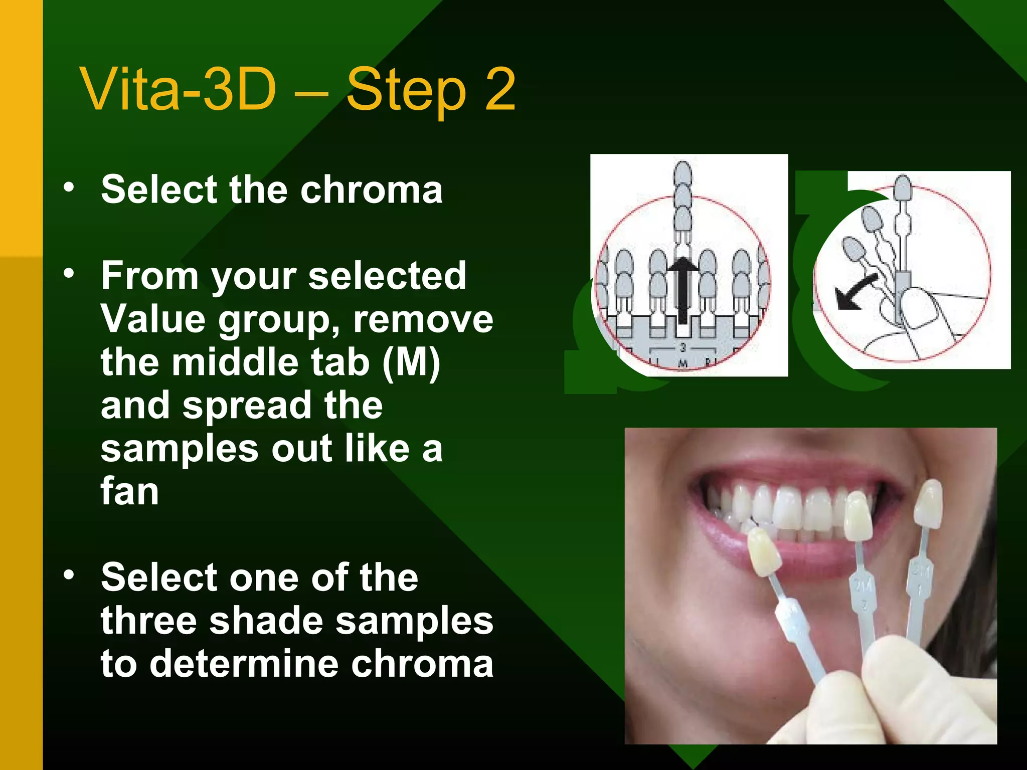 Vita-3D – Step 2
• Select the chroma
• From your selected
Value group, remove
the middle tab (M)
and spread the
samples out like a
fan
• Select one of the
three shade samples
to determine chroma
 
