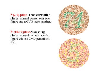 Colorblindness | PPT