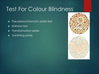 Test For Colour Blindness 
 Pseudoisochromatic plate test 
 Ishihara test 
 Transformation plate 
 Vanishing plate 
 