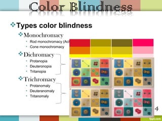 Types color blindness
  Monochromacy
    • Rod monochromacy (Achromatopsia)
    • Cone monochromacy

  Dichromacy
    • Protanopia
    • Deuteronopia
    • Tritanopia

  Trichromacy
    • Protanomaly
    • Deuteranomaly
    • Tritanomaly
 