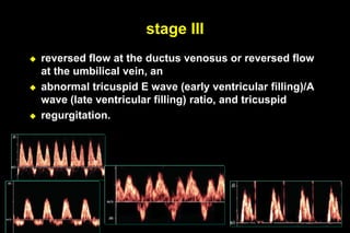 Color doppler in fetal hypoxia | PPTX