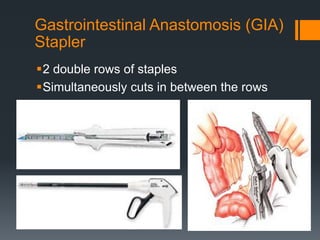 Staplered Colorectal anastomosis | PPTX