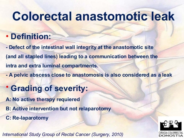 colorectal anastomosis leakeage sorrento 2010 anastomosis
