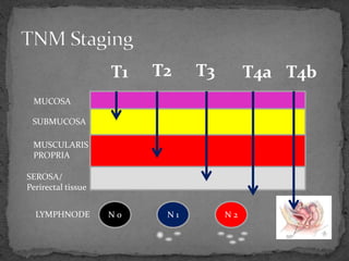 N 0 N 1 N 2
T1 T2 T3 T4a T4b
MUCOSA
SUBMUCOSA
MUSCULARIS
PROPRIA
SEROSA/
Perirectal tissue
LYMPHNODE
 
