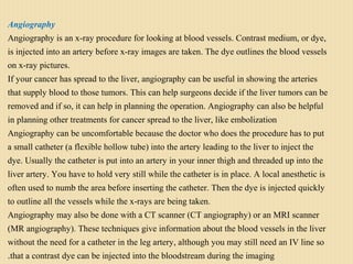 Angiography
Angiography is an x-ray procedure for looking at blood vessels. Contrast medium, or dye,
is injected into an artery before x-ray images are taken. The dye outlines the blood vessels
on x-ray pictures.
If your cancer has spread to the liver, angiography can be useful in showing the arteries
that supply blood to those tumors. This can help surgeons decide if the liver tumors can be
removed and if so, it can help in planning the operation. Angiography can also be helpful
in planning other treatments for cancer spread to the liver, like embolization
Angiography can be uncomfortable because the doctor who does the procedure has to put
a small catheter (a flexible hollow tube) into the artery leading to the liver to inject the
dye. Usually the catheter is put into an artery in your inner thigh and threaded up into the
liver artery. You have to hold very still while the catheter is in place. A local anesthetic is
often used to numb the area before inserting the catheter. Then the dye is injected quickly
to outline all the vessels while the x-rays are being taken.
Angiography may also be done with a CT scanner (CT angiography) or an MRI scanner
(MR angiography). These techniques give information about the blood vessels in the liver
without the need for a catheter in the leg artery, although you may still need an IV line so
that a contrast dye can be injected into the bloodstream during the imaging.
 