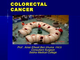 COLORECTALCOLORECTAL
CANCERCANCER
Prof . Amer Eltwati Ben Irhuma FRCS
Consultant Surgeon
Sebha Medical College
 