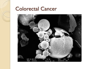 colorectalcancesample and diagnosis and treatment | PDF