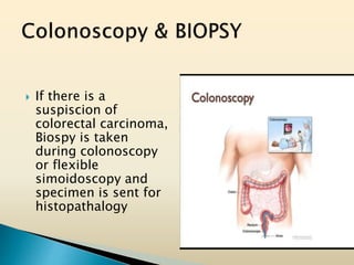  If there is a
suspiscion of
colorectal carcinoma,
Biospy is taken
during colonoscopy
or flexible
simoidoscopy and
specimen is sent for
histopathalogy
 