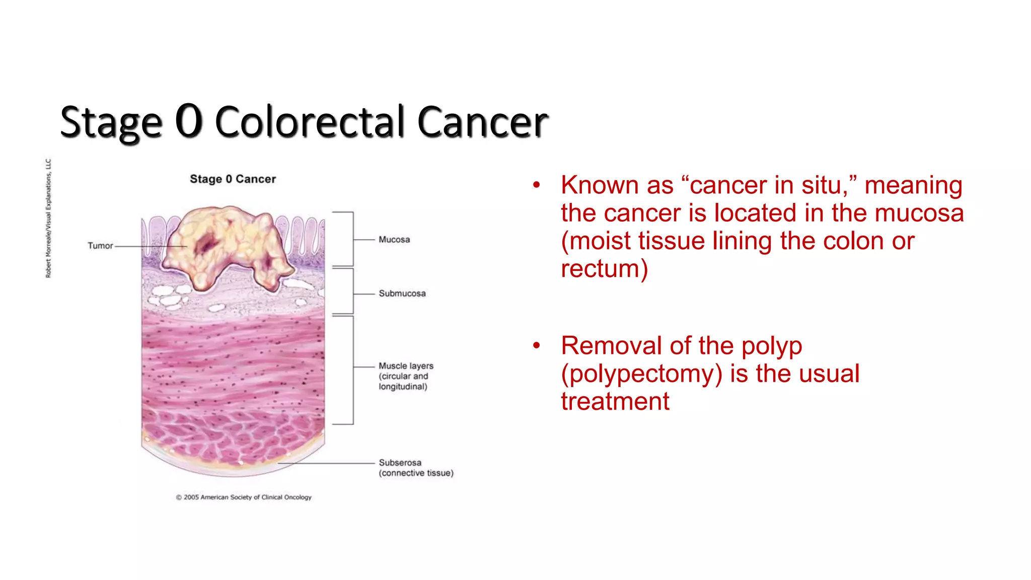 Colorectal carcinoma anatomy to management PPTX