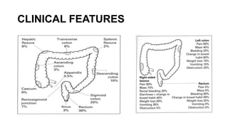 Colorectal carcinoma  anatomy to management