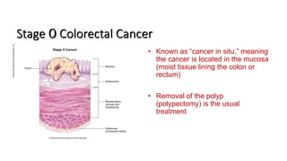 Stage 0 Colorectal Cancer
• Known as “cancer in situ,” meaning
the cancer is located in the mucosa
(moist tissue lining the colon or
rectum)
• Removal of the polyp
(polypectomy) is the usual
treatment
 