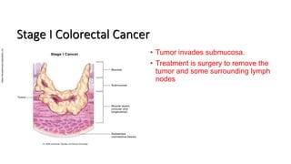 Colorectal carcinoma  anatomy to management