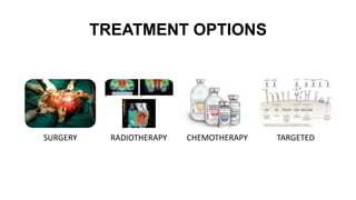 TREATMENT OPTIONS
SURGERY RADIOTHERAPY CHEMOTHERAPY TARGETED
 