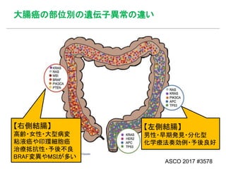 大腸癌の部位別の遺伝子異常の違い
ASCO 2017 #3578
【右側結腸】
高齢・女性・大型病変
粘液癌や印環細胞癌
治療抵抗性・予後不良
BRAF変異やMSIが多い
【左側結腸】
男性・早期発見・分化型
化学療法奏効例・予後良好
 