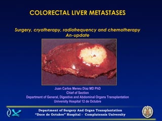 COLORECTAL LIVER METASTASES
Surgery, cryotherapy, radiofrequency and chemotherapy
An-update
Juan Carlos Meneu Diaz MD PhD
Chief of Section
Department of General, Digestive and Abdominal Organs Transplantation
University Hospital 12 de Octubre
Department of Surgery And Organ Transplantation
“Doce de Octubre” Hospital - Complutensis University
 