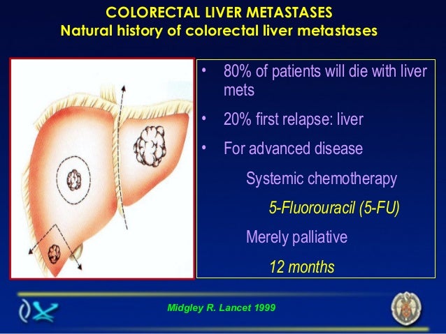 Colon Cancer Natural History Colon Cancer Natural History