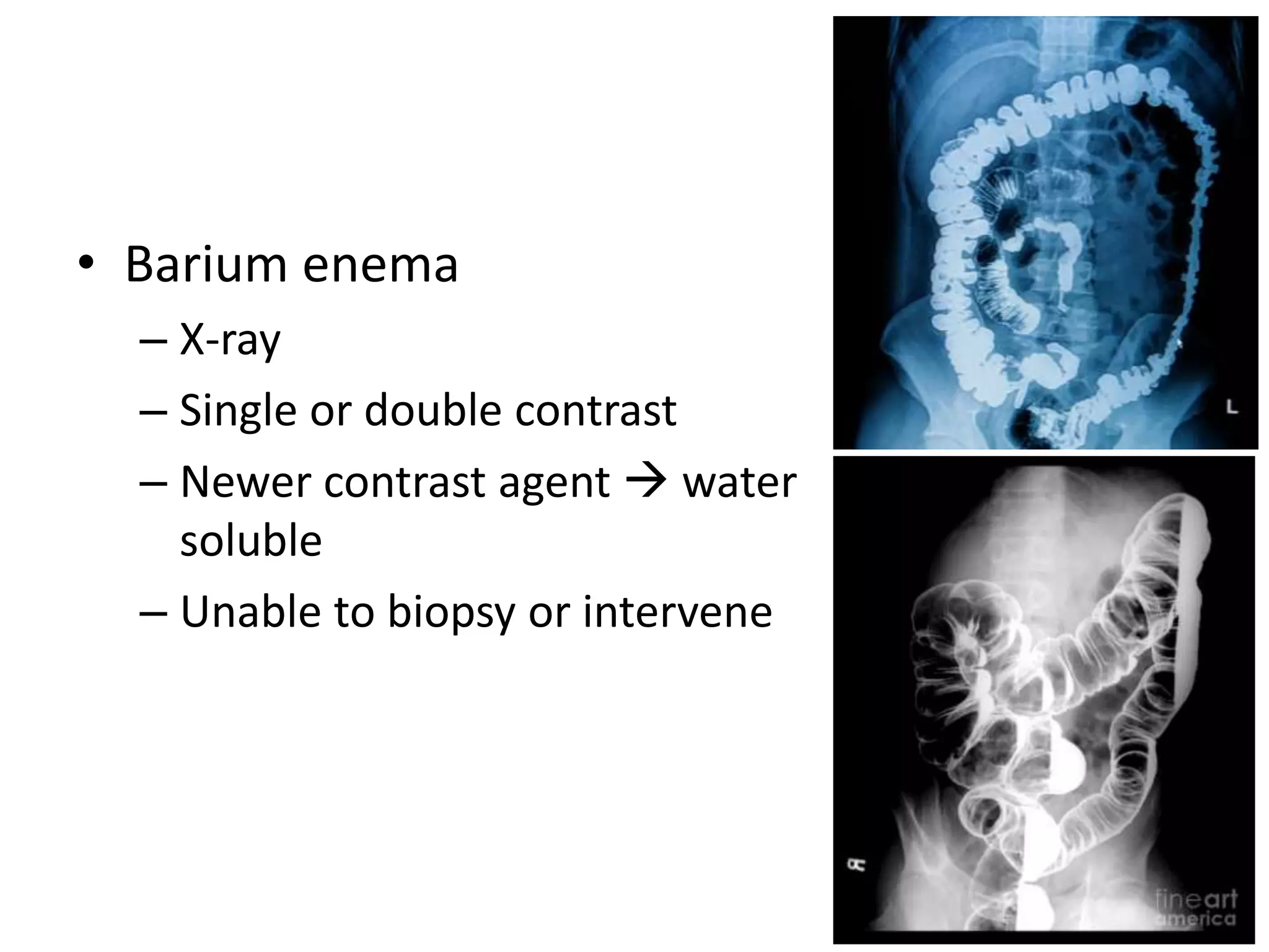 • Barium enema
– X-ray
– Single or double contrast
– Newer contrast agent  water
soluble
– Unable to biopsy or intervene
 