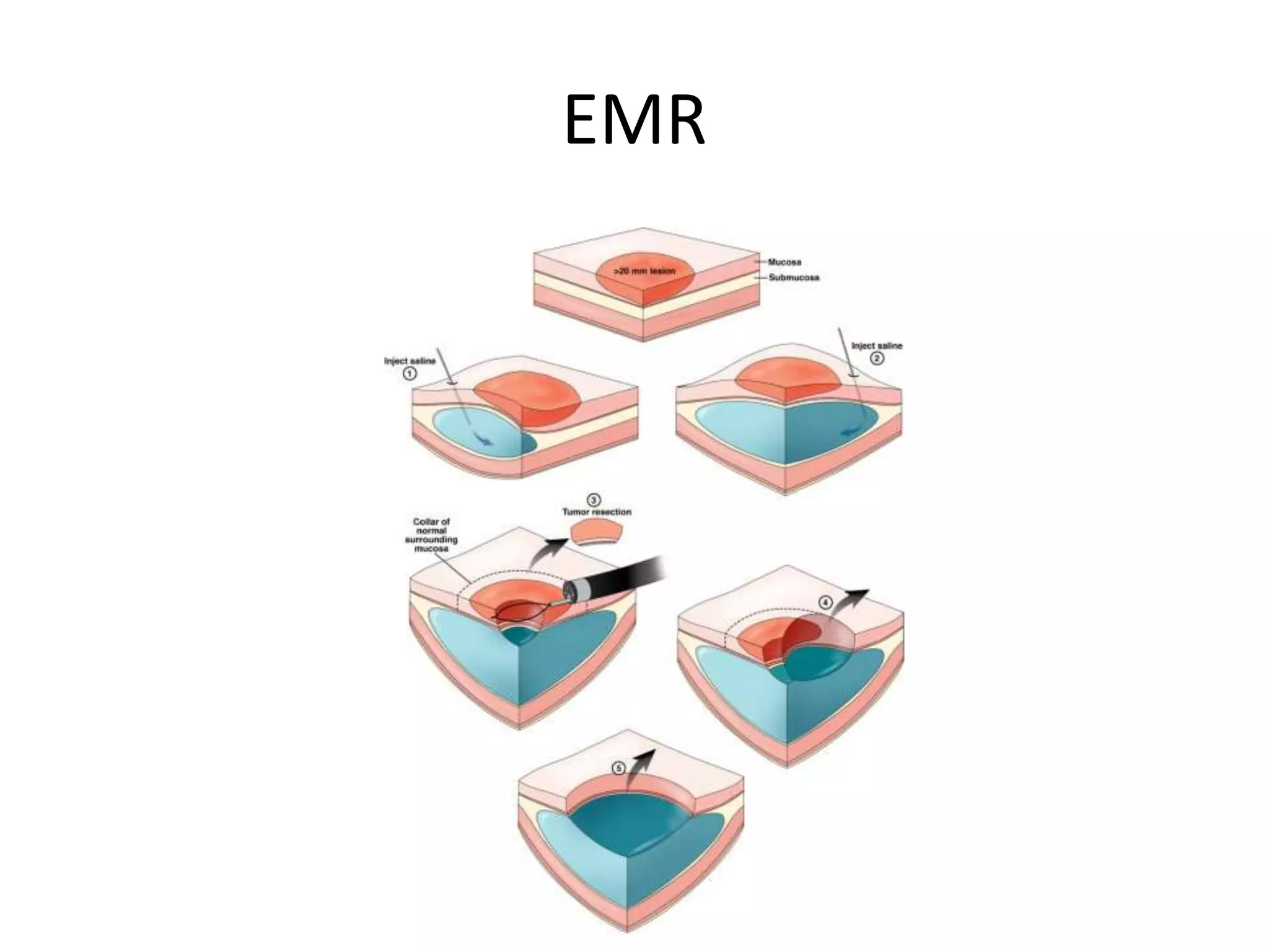 EMR
 
