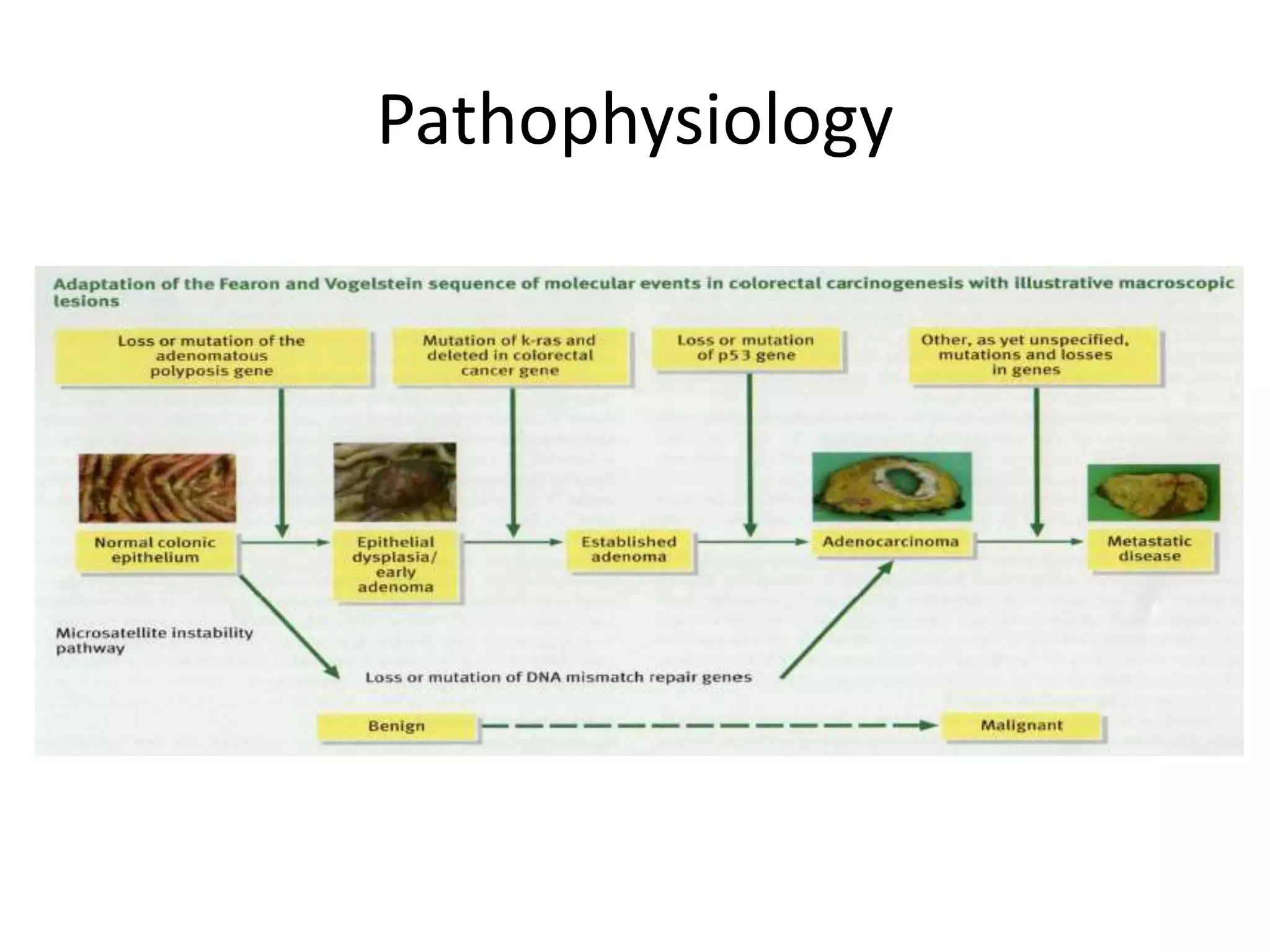 Pathophysiology
 