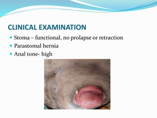 CLINICAL EXAMINATION
 Stoma – functional, no prolapse or retraction
 Parastomal hernia
 Anal tone- high
 